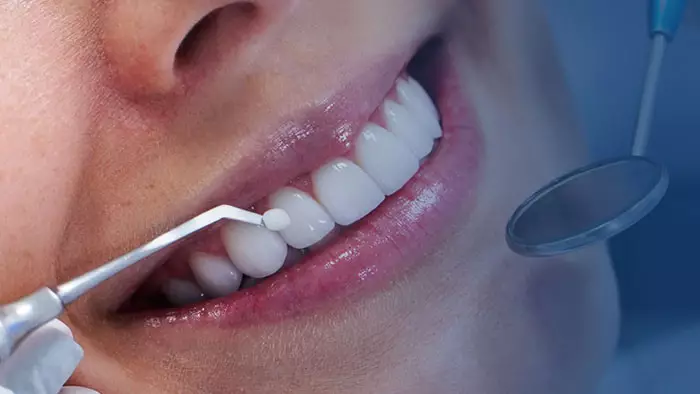 Estética Odontológica